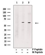 Phospho-KV1.1 (KCNA1) (Ser446) Polyclonal Antibody