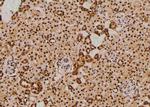 Phospho-NOTCH3 (Ser84) Antibody in Immunohistochemistry (Paraffin) (IHC (P))