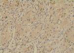 Phospho-SGLT1 (Ser335) Polyclonal Antibody