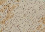 Phospho-SETD2 (Ser532) Polyclonal Antibody