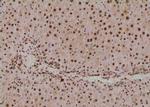 Phospho-SETD8 (Ser100) Antibody in Immunohistochemistry (Paraffin) (IHC (P))