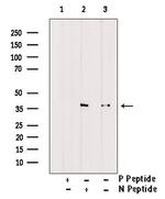 Phospho-FBP1 (Tyr265) Polyclonal Antibody