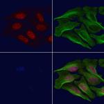 Phospho-BCL11A (Ser205) Polyclonal Antibody