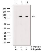 Phospho-PFKM (Ser74) Polyclonal Antibody