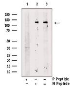 Phospho-ZEB1 (Ser887) Polyclonal Antibody