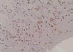 Phospho-FMRP (Ser500) Polyclonal Antibody