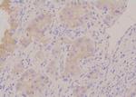 Phospho-HPRT1 (Ser110) Polyclonal Antibody