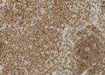 Phospho-TAB1 (Tyr481) Antibody in Immunohistochemistry (Paraffin) (IHC (P))