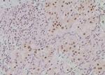 Phospho-TRIM32 (Ser339) Polyclonal Antibody
