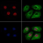 Phospho-Caspase 2 Precursor (Ser340) Polyclonal Antibody