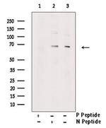 Phospho-PINK1 (Ser228) Antibody in Western Blot (WB)