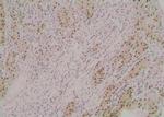 Phospho-ATG3 (Tyr18) Polyclonal Antibody