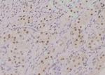 Phospho-BACH1 (Ser445) Polyclonal Antibody