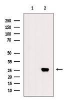 Phospho-CDC34 (Ser71) Antibody in Western Blot (WB)