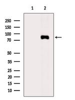 Phospho-CTNNAL1 (Tyr436) Antibody in Western Blot (WB)