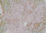 Phospho-CTNNAL1 (Tyr436) Antibody in Immunohistochemistry (Paraffin) (IHC (P))