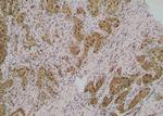 Phospho-ABCB11 (Ser690) Polyclonal Antibody