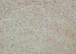 Phospho-ARHGAP42 (Tyr792) Antibody in Immunohistochemistry (Paraffin) (IHC (P))