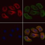 Phospho-Annexin A2 (Tyr24) Polyclonal Antibody