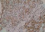 Phospho-Annexin A2 (Tyr24) Antibody in Immunohistochemistry (Paraffin) (IHC (P))