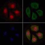 Phospho-BMAL1 (Ser49) Polyclonal Antibody