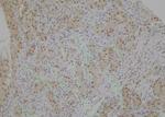 Phospho-DNM1L (Ser529) Antibody in Immunohistochemistry (Paraffin) (IHC (P))
