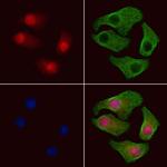 Phospho-PDCD5 (Ser119) Polyclonal Antibody