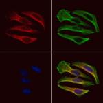 Phospho-MYPT1 (Tyr766) Polyclonal Antibody