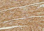 Phospho-Bim (Ser98) Antibody in Immunohistochemistry (Paraffin) (IHC (P))