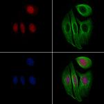 Phospho-FOXO3A (Ser284) Polyclonal Antibody