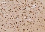 Phospho-LAT (Ser84) Polyclonal Antibody