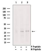 Phospho-LAT (Ser84) Antibody in Western Blot (WB)