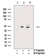 Phospho-Doublecortin (Ser332) Polyclonal Antibody