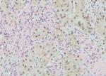 Phospho-KIF1B (Ser1057) Polyclonal Antibody