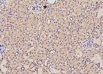 Phospho-AS160 (Ser570) Polyclonal Antibody