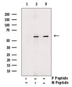 Phospho-DOK2 (Tyr402) Antibody in Western Blot (WB)