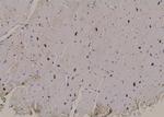 Phospho-PFKFB2 (Ser32) Antibody in Immunohistochemistry (Paraffin) (IHC (P))