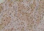 Phospho-ROCK2 (Ser1379) Polyclonal Antibody