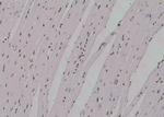 Phospho-ROCK2 (Ser1379) Antibody in Immunohistochemistry (Paraffin) (IHC (P))
