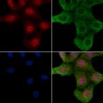 Phospho-ROCK2 (Ser1366) Polyclonal Antibody