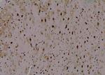 Phospho-ULK1 (Thr1046) Antibody in Immunohistochemistry (Paraffin) (IHC (P))