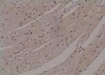 Phospho-ULK1 (Thr1046) Polyclonal Antibody