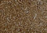 Phospho-ULK1 (Thr1046) Antibody in Immunohistochemistry (Paraffin) (IHC (P))