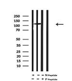 Phospho-ULK1 (Thr1046) Antibody in Western Blot (WB)