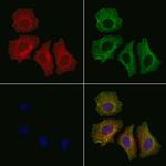 Phospho-IRE1 alpha (Tyr628) Polyclonal Antibody