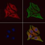 Phospho-DR6 (Thr460) Polyclonal Antibody