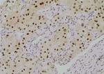 Phospho-SF3B1 (Thr211) Polyclonal Antibody