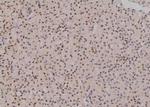Phospho-SF3B1 (Thr211) Antibody in Immunohistochemistry (Paraffin) (IHC (P))
