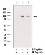 Phospho-MSK1 (Ser212) Polyclonal Antibody