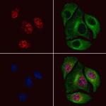 Phospho-MSK2 (Thr687) Polyclonal Antibody